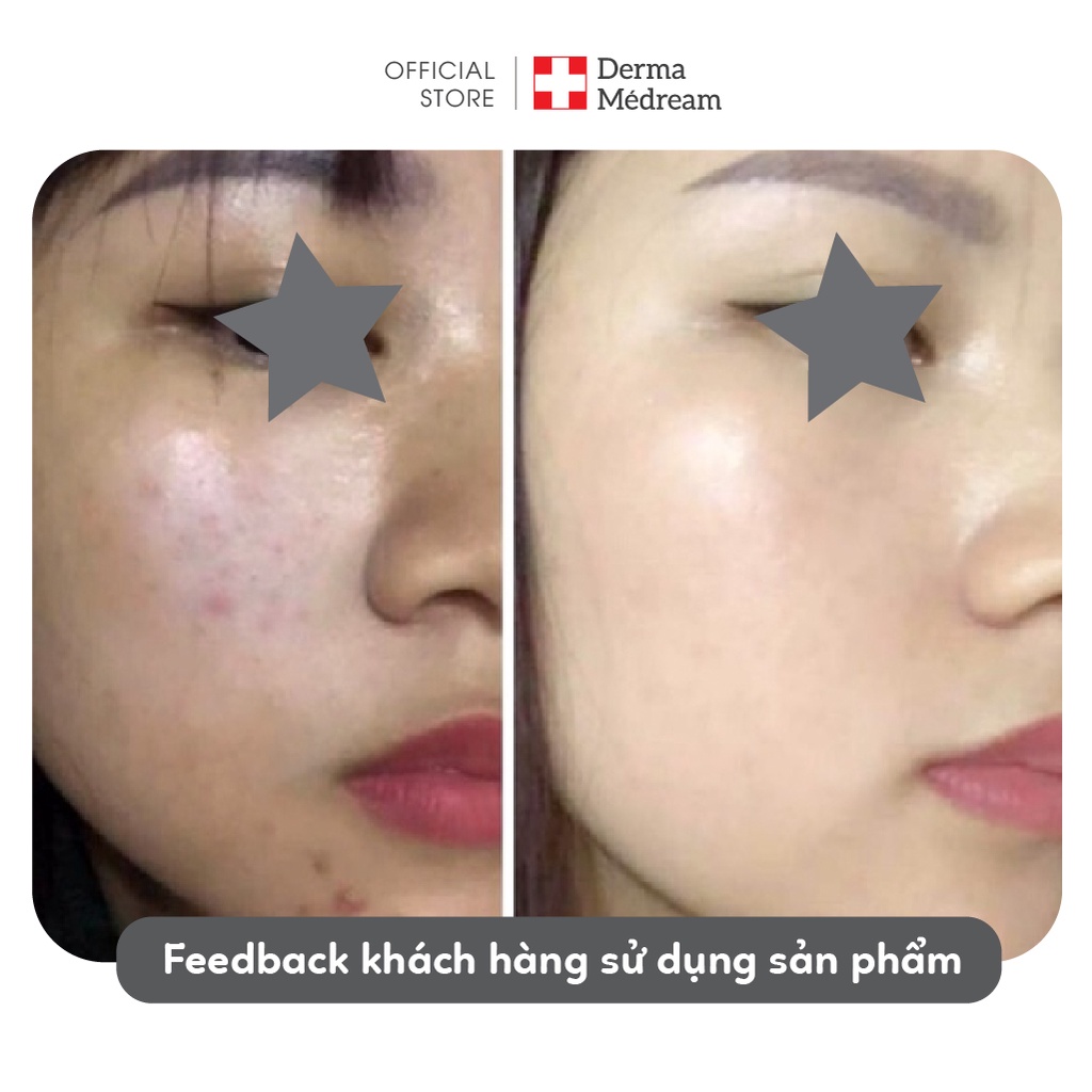 Serum Vitamin C Derma Me'Dream, dưỡng trắng, giảm thâm, giảm nám tàn nhang và làm đều màu da - Chai 50ml