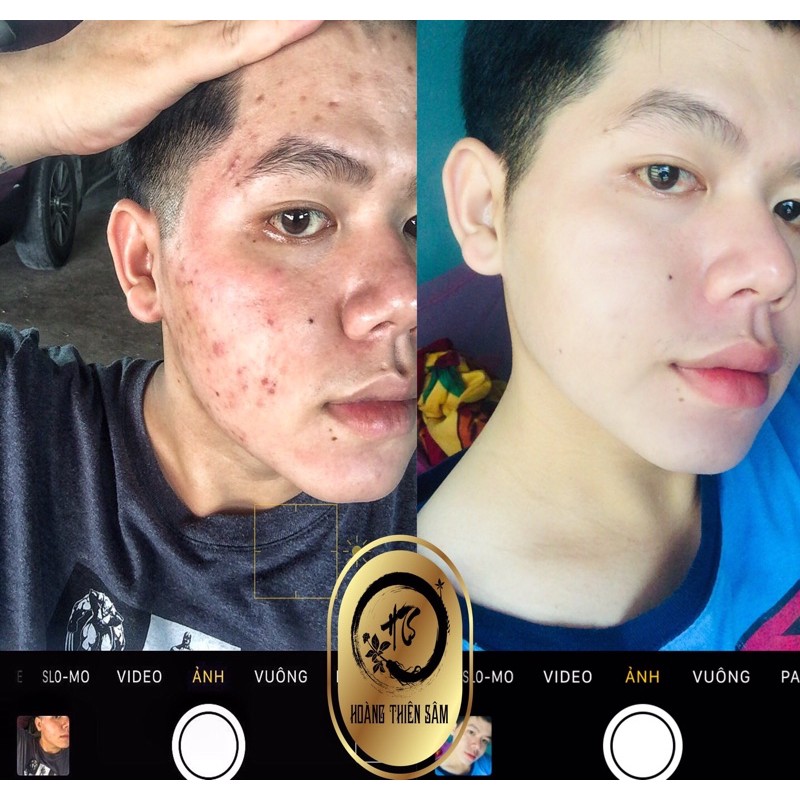 Combo Hoàng Thiên Sâm ⚡️Freeship ⚡️Trả lại làn Da hồng Hào, thanh Xuân cho bạn