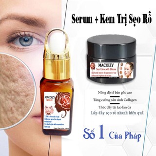 Bộ Đôi Sản Phẩm Đầy Sẹo Rỗ Sẹo Mụn Sẹo Thâm
