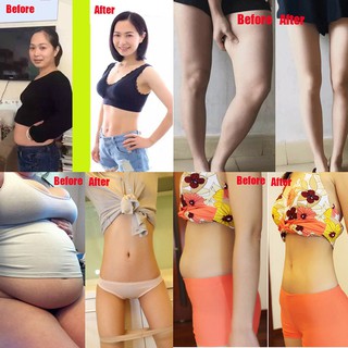 10 Miếng Dán Giảm Cân