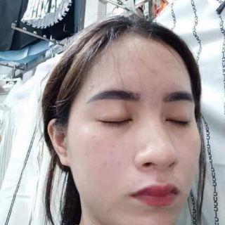 Hana Acnes
