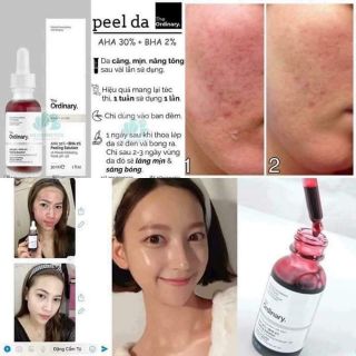 SERUM THE ORDINARY 
 – AHA 30% + BHA 2% PEELING SOLUTION