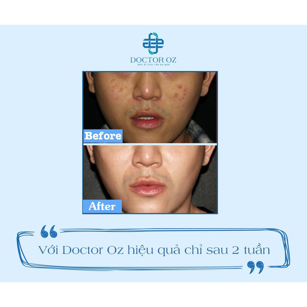 Tinh Chất Serum Hỗ Trợ Làm Giảm Mụn Chiết Xuất Tràm Trà Doctor Oz 5ml