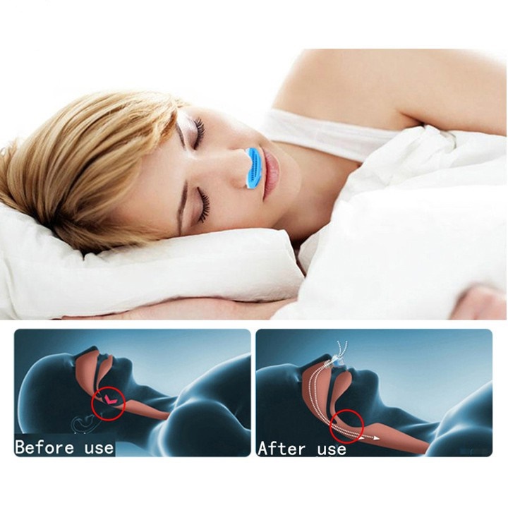 Dụng Cụ Chống Ngáy Ngủ 2 in 1 - Thiết Bị Hỗ Trợ Chống Ngủ Ngáy (chinh hãng)
