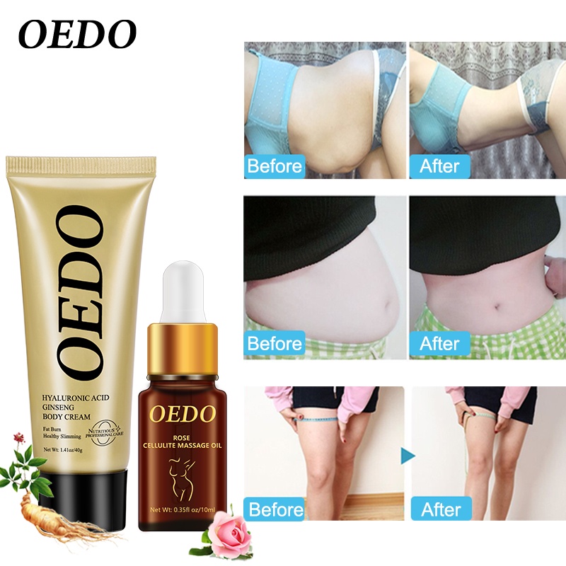 Bộ giảm béo OEDO Kem tan mỡ bụng và giảm rạn da cao cấp cam kết eo thon đốt cháy mỡ thừa làm thon gọn vùng