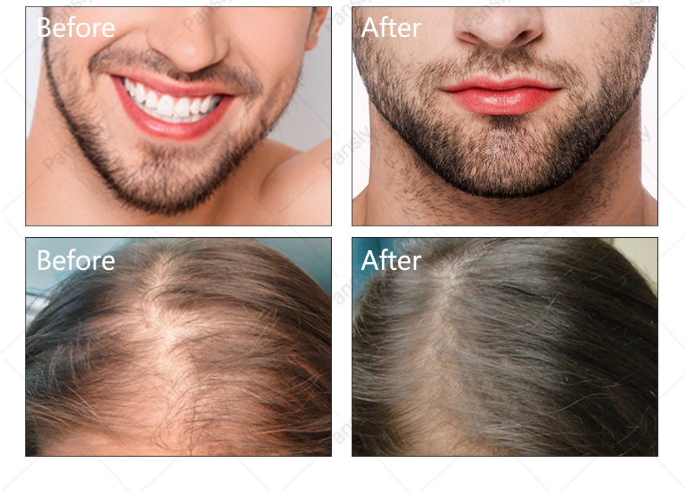 Tinh dầu hạt thầu dầu PANSLY kích thích mọc lông mi/lông mày/râu hiệu quả 10ml | BigBuy360 - bigbuy360.vn