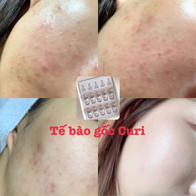 [Tách Lẻ] Tế Bào Gốc CURI Siêu Căng Bóng Và Tái Tạo Da Thần Tốc | BigBuy360 - bigbuy360.vn