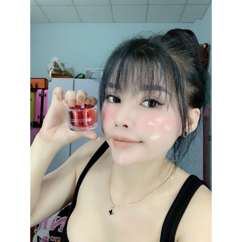 KEM DƯỠNG XÓA THÂM MỜ NÁM NGĂN NGỪA MỤN | BigBuy360 - bigbuy360.vn