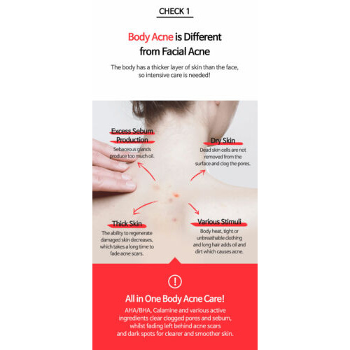 Sữa Dưỡng Thể TIAM Chống Khuyết Điểm Dùng Cho Lưng Và Ngực 200ml | BigBuy360 - bigbuy360.vn