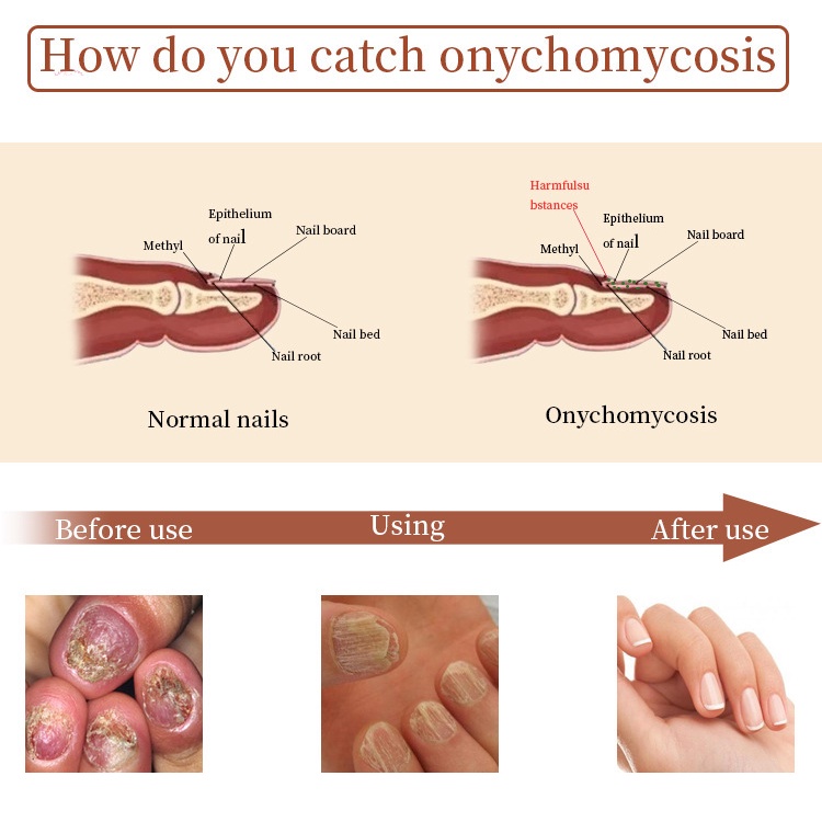Serum Kích Thích Mọc Móng Nhanh Chóng Và Hiệu Quả