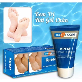 Kem trị nứt gót chân apteka kpem