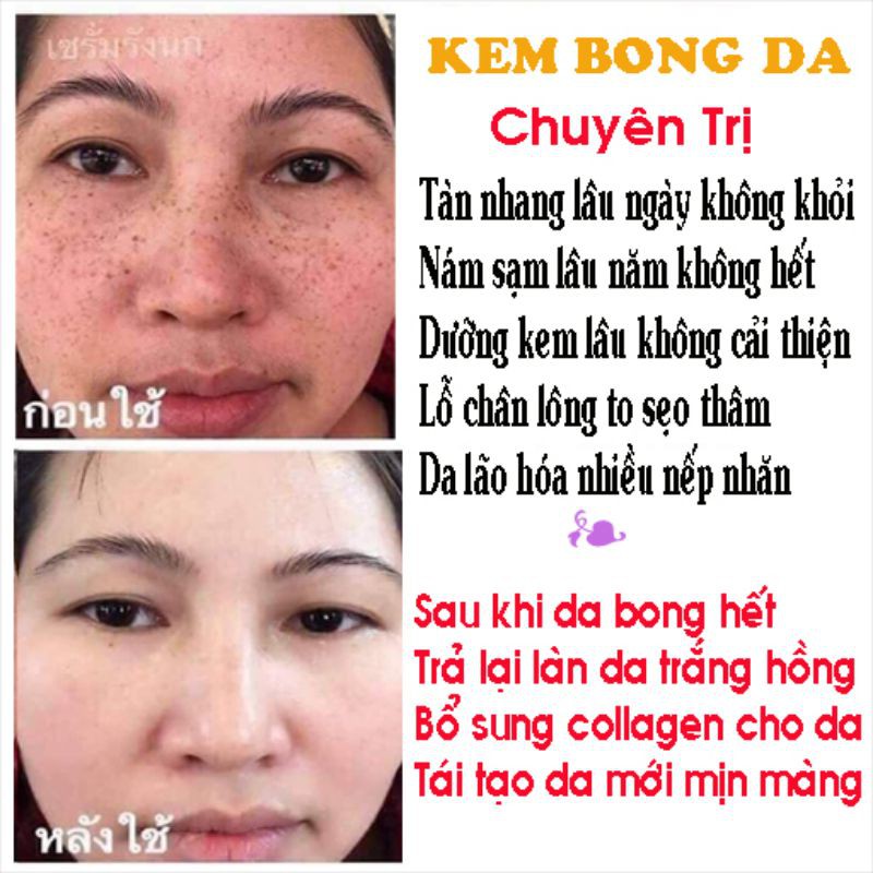 KEM BONG TÁI TẠO TRẮNG DA