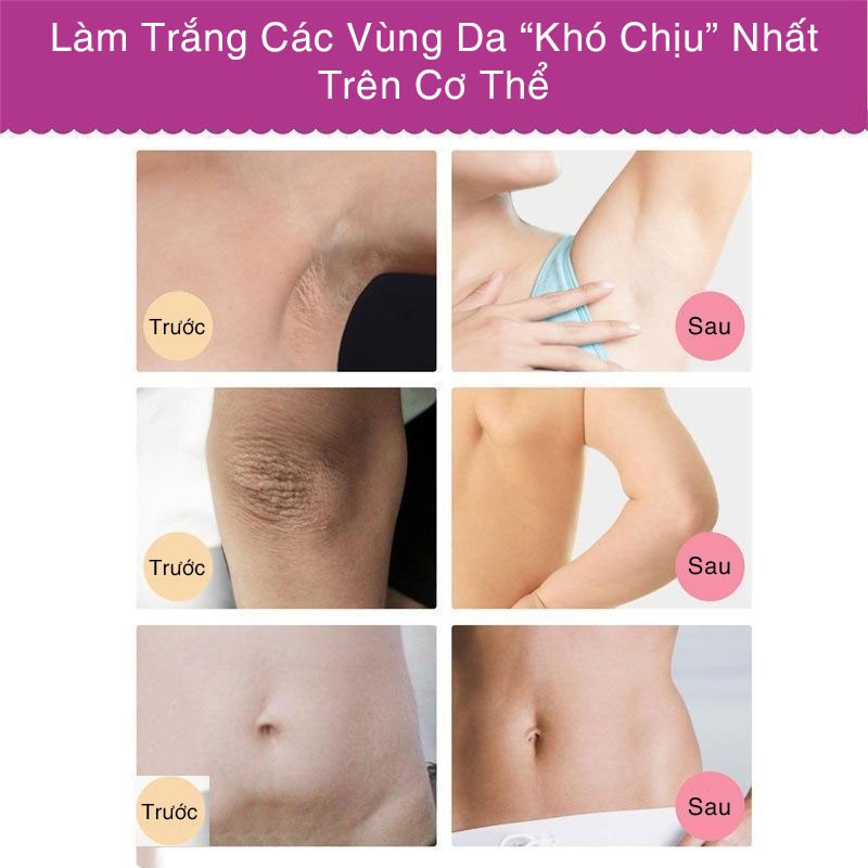 Kem làm trắng da 60g dưỡng trắng body làm hồng nhũ hoa và vùng kín an toàn không có tác dụng phụ