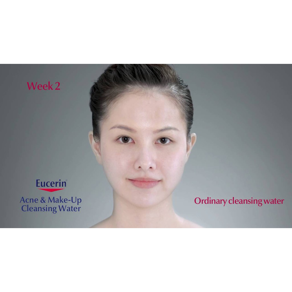 Nước Tẩy Trang Dành Cho Da Mụn Eucerin Pro ACNE Solution Acne &amp; Make-up Cleansing Water 200ml