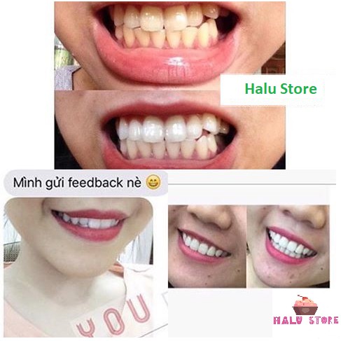 Combo 7 gói/7 ngày miếng dán trắng răng Crest 3D White Whitestrips loại 1 Hour - Mỹ (7 gói)