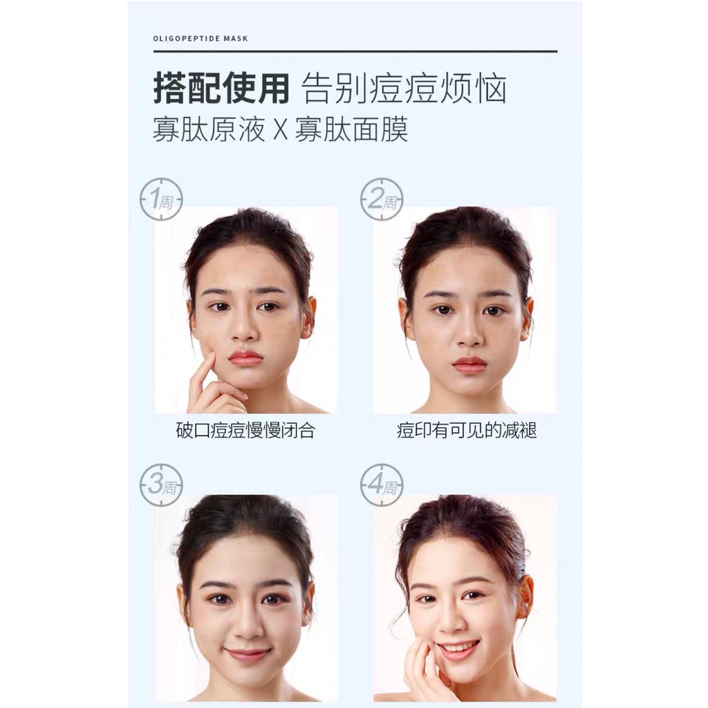 Mặt nạ Oligopeptide Lucenbase phục hồi da | Thế Giới Skin Care