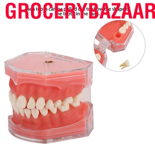 Grocerybazaar Gingiva Model Removable Teeth Soft Oral Demonstrating Dental Practice Teaching Tool