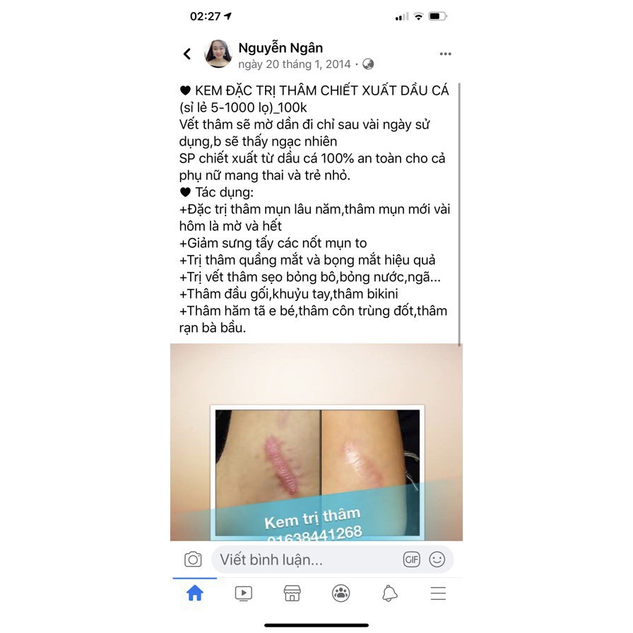 (Mẫu mới 25gr) Kem thâm dầu cá, mờ vết thâm mụn, thâm muỗi.... mới hàng chuẩn công ty chính hãng | BigBuy360 - bigbuy360.vn