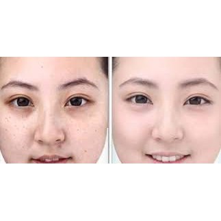 Kem Enya Dưỡng Da Chống Lão Hóa Ngừa Mụn