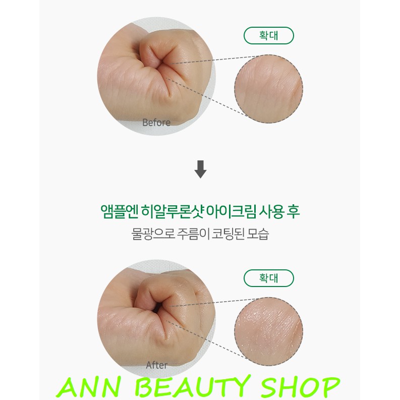 Kem Dưỡng Ẩm Giảm Thâm Quầng Mắt Coreana Hyaluron Shot Eye Cream 25ml | BigBuy360 - bigbuy360.vn