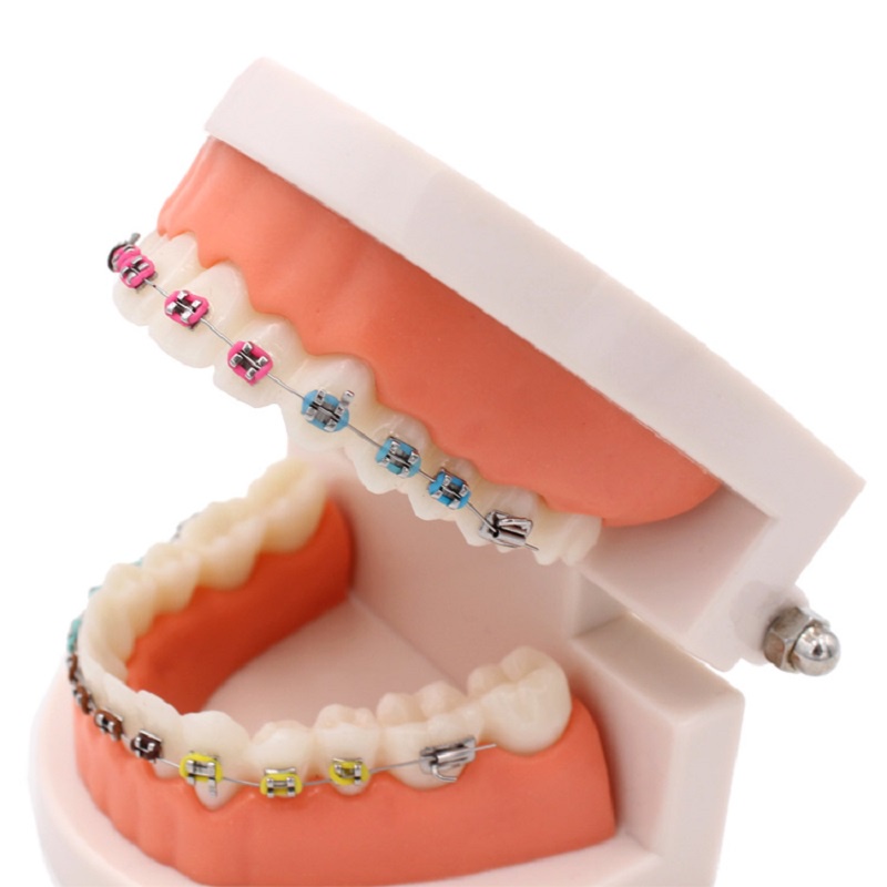 [Hàng mới về] Mô hình niềng bàn chỉnh nha chuyên dụng với giá đỡ kim loại uốn cong