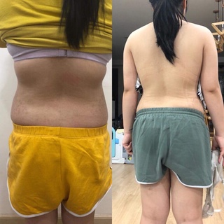 Gen Latex Giảm Mỡ Lưng Và Bụng