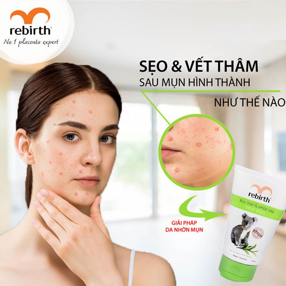 Sữa rửa mặt, gel rửa mặt cho da dầu, tinh chất trà xanh và trà trắng Rebirth - 100ml - Nhập Khẩu Úc, Ngăn Ngừa Mụn