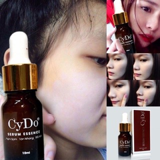 serum essence nám sạm tàn nhang 10ml
