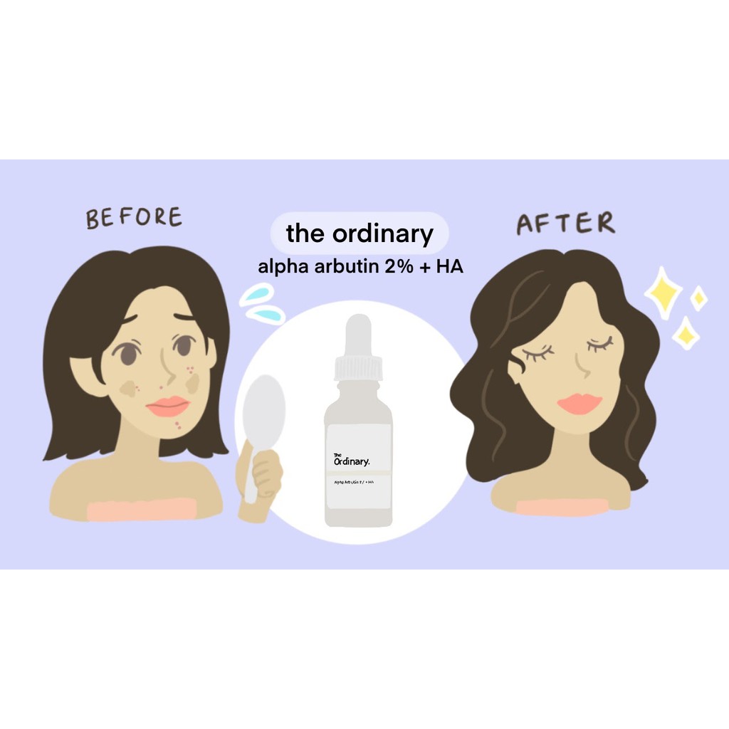 The Ordinary Alpha Arbutin 2% + HA Hyperpigmentation Serum trắng da, mờ thâm 30mil TOTO shop