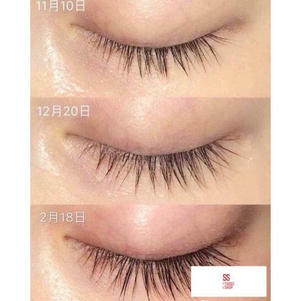 Kem làm mờ mụn thịt Tsubuporon Nhật Bản | BigBuy360 - bigbuy360.vn