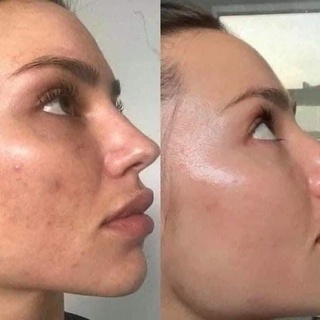 NhuyNhuy_store🍀 THE ORDINARY AHA 30% BHA 2% PEELING SOLUTION .