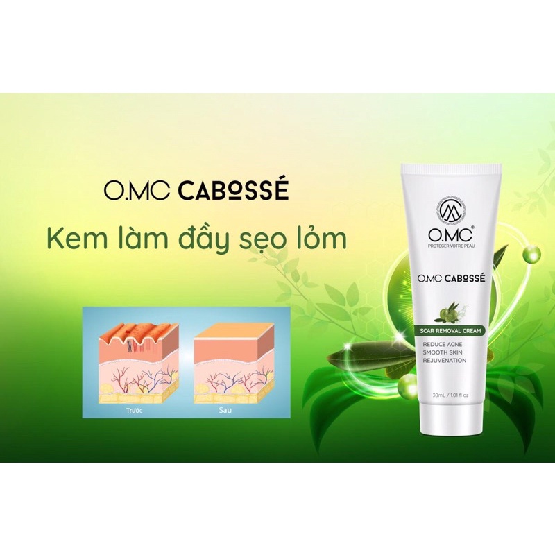 Kem đầy sẹo lõm omc 30ml