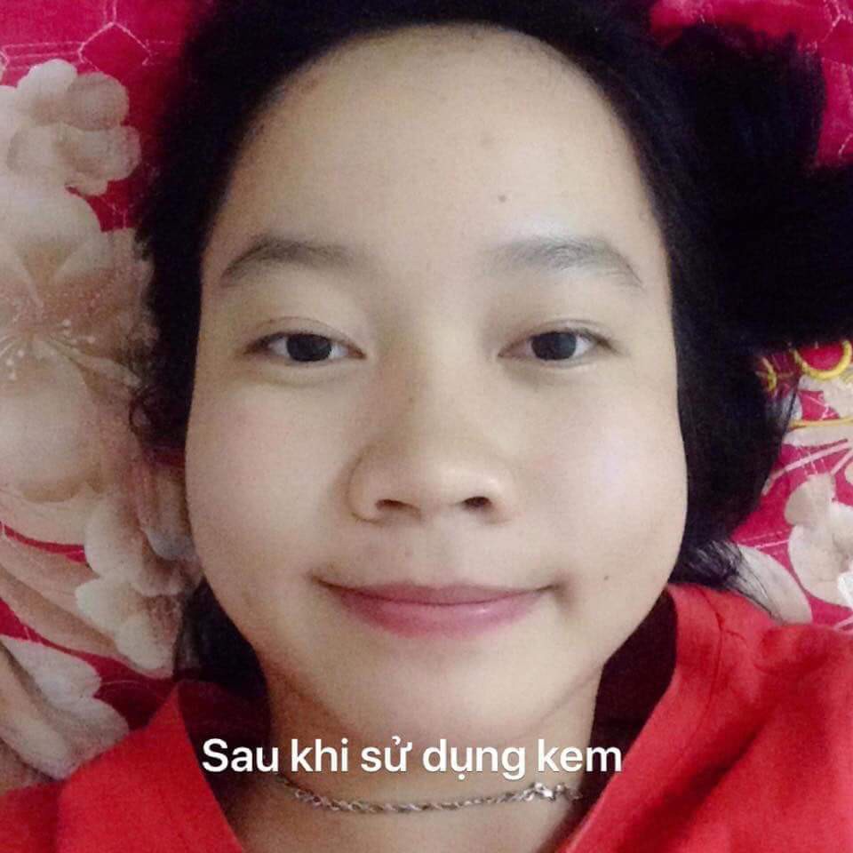 Kem hoa cúc pau jen pai(1 ngày 1 đêm) | BigBuy360 - bigbuy360.vn