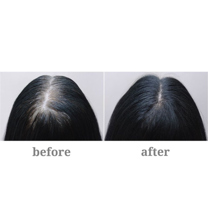 Tinh chất Copper Peptide  ✅ freeship ✅ giúp trẻ hoá da, phụ.c hồ.i da sau lăn kim