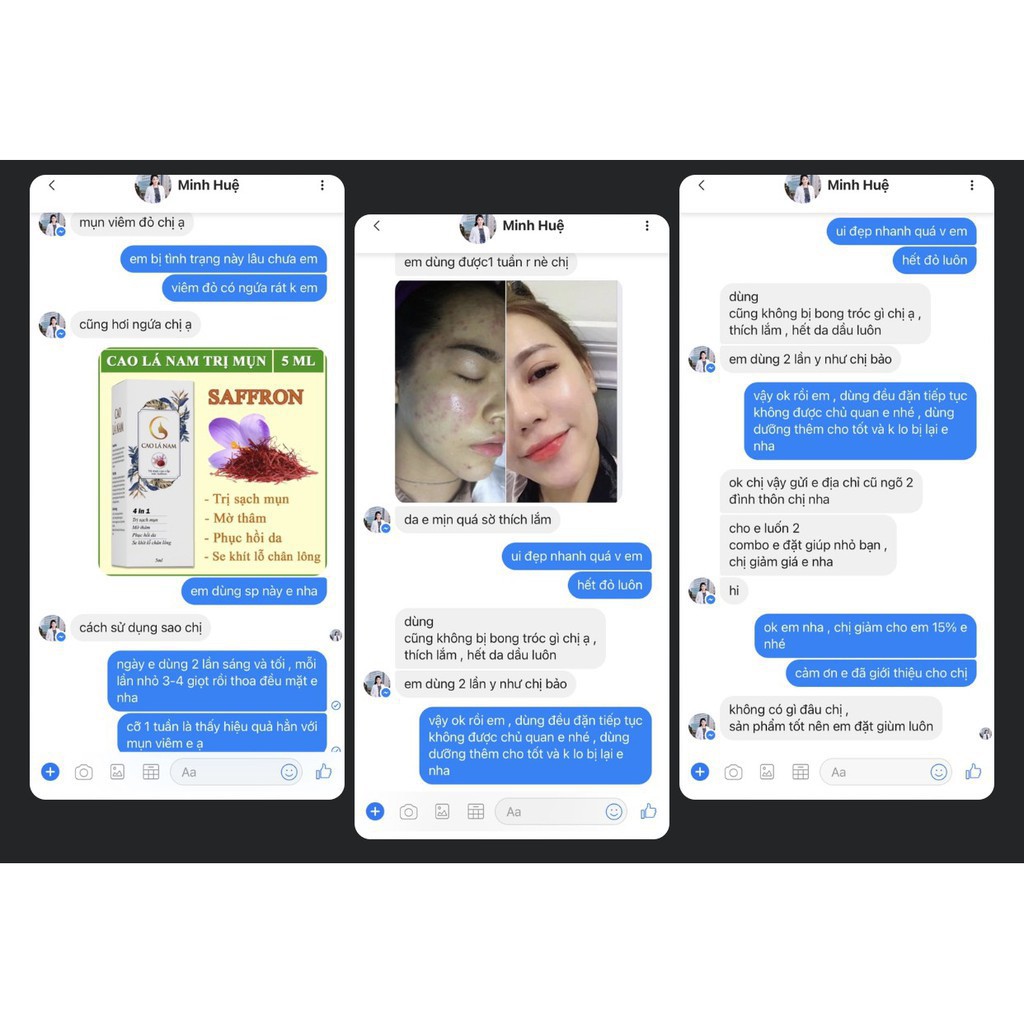 💕COMBO 4 Hộp💕 Cao lá nam loai cao cấp [Không sưng bong] | BigBuy360 - bigbuy360.vn