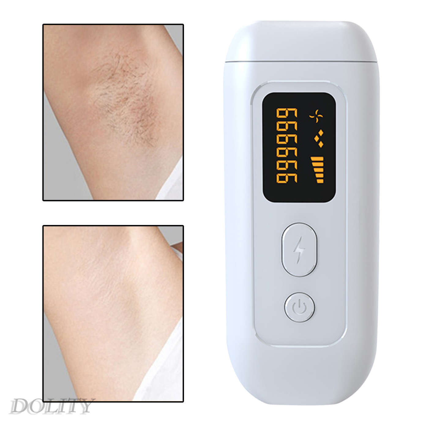 (Hàng Mới Về) Máy Triệt Lông Bằng Laser 990000 Flashes Có Phích Cắm Uk | BigBuy360 - bigbuy360.vn