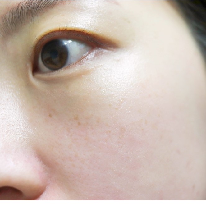 Tinh chất  COLLAGEN EUNYUL VITA COLLAGEN  AMPOULE - TINH CHẤT DƯỠNG TRẮNG - NGỪA NÁM, TÀN NHANG