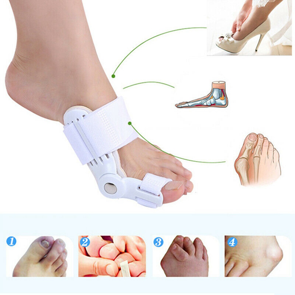 Set 2 Đai Nẹp Định Hình Ngón Chân Cái