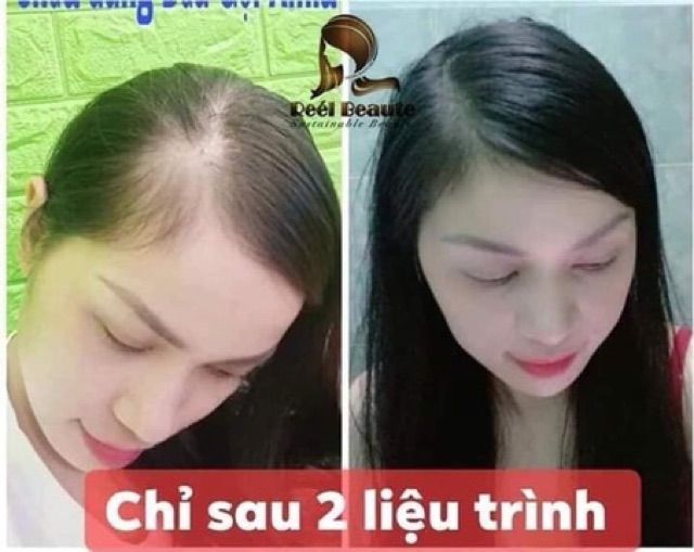 Duy Nhất Hôm Nay - TÚI LỌC GỘI ĐẦU THẢO DƯỢC REEL BEAUTE - Sản phẩm VÀNG cứu dỗi mái TÓC rụng khô xơ hư tổn cho bạn