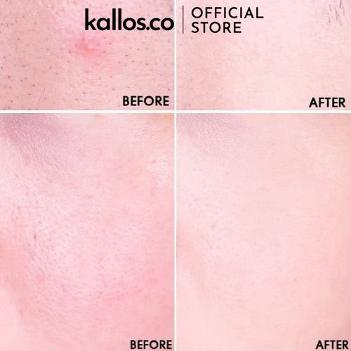 Che Khuyết Điểm Etude House Big Cover Concealer Skin Fit Pro - Kallos Vietnam