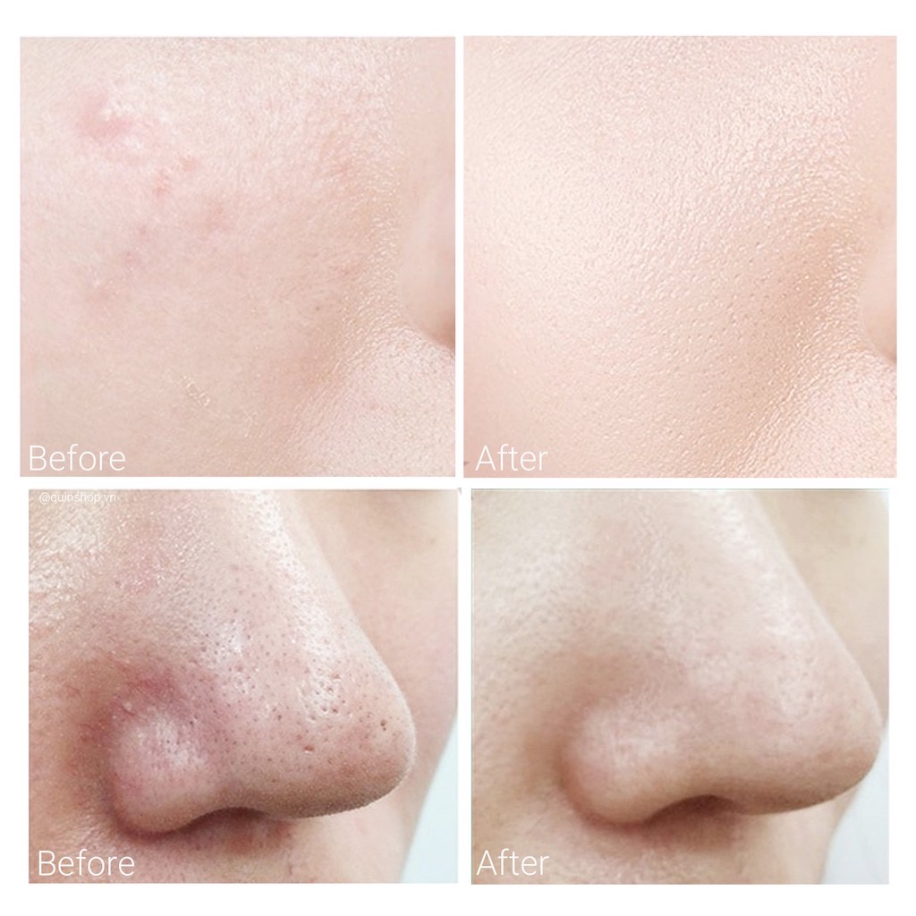 (Chính hãng) Tẩy tế bào chết hóa học CNP Laboratory Invisible Peeling Booster