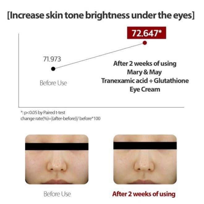 KEM MẮT dưỡng trắng giảm thâm quầng mắt kiêm kem nám Mary&May