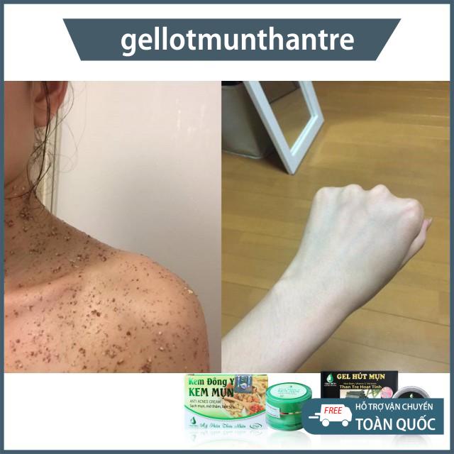 Ủ trắng cafe đậu đỏ 100gr dùng cho face body chính hãng,bột đậu đỏ,ủ trắng cà phê đậu đỏ | BigBuy360 - bigbuy360.vn