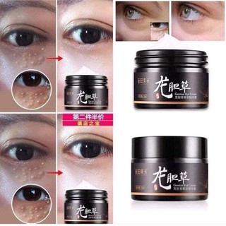 Kem đặc trị mụn thịt quanh mắt