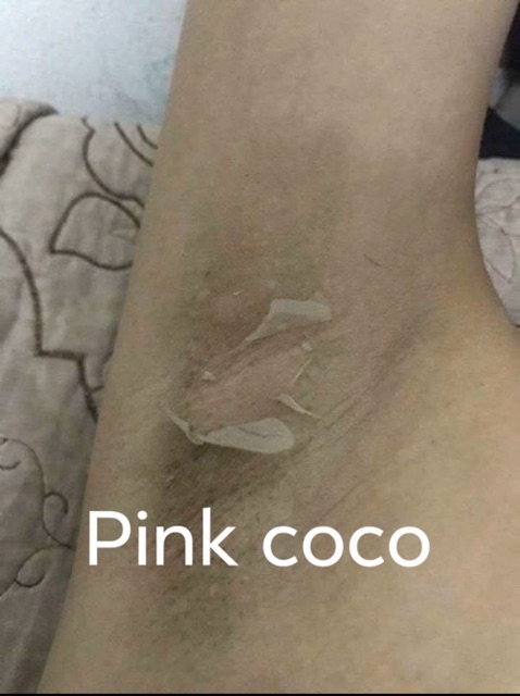 [HÀNG AUTH] Kem trị thâm nách pink coco
