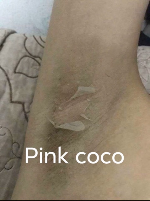 KEM KHỬ THÂM NÁCH PINK COCO ( hũ trắng peel)