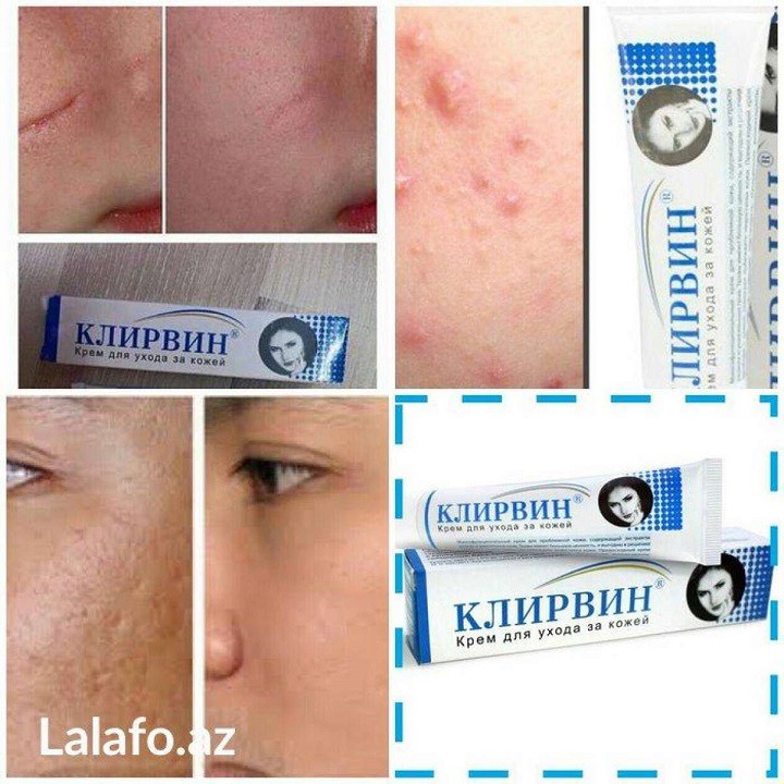 Kem KLIRVIN Chuyên Gia Làm Mờ Sẹo 25G của Nga
