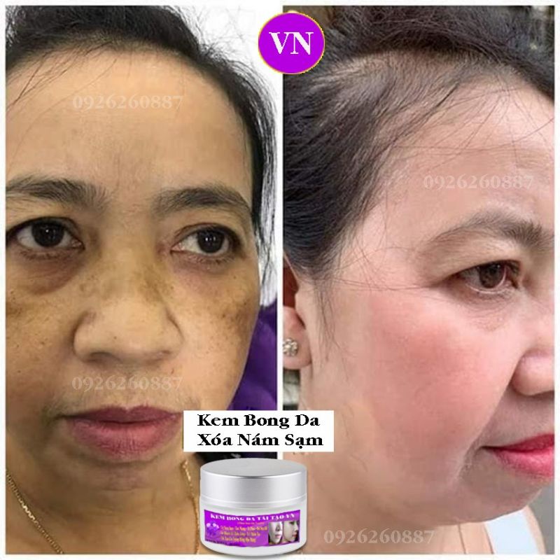 Kem  Bong Da mờ nám Bổ sung Collagen