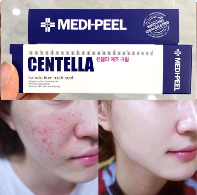 Kem Rau Má Hỗ Trợ Giảm Mụn Phục Hồi Da MEDI PEEL CENTELLA MEZZO CREAM (Tuýp xanh dương)