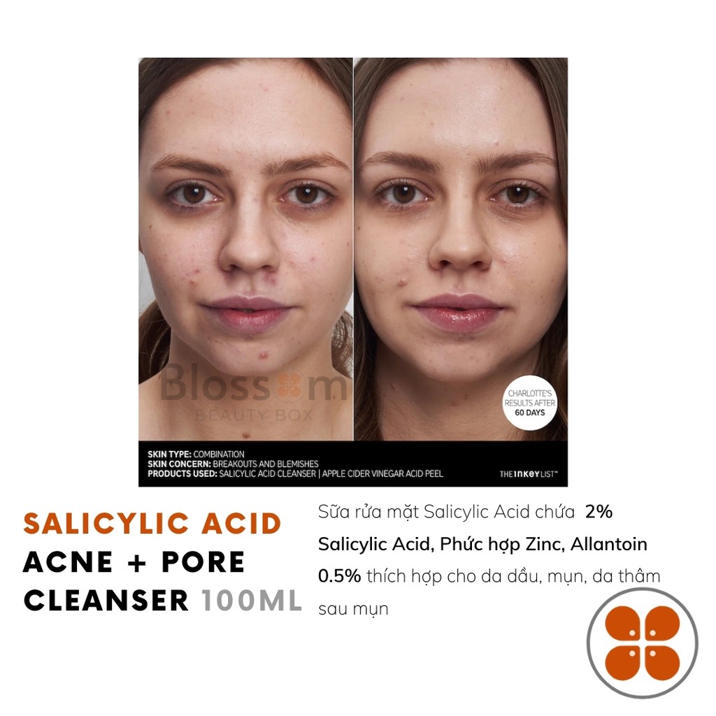 Sữa rửa mặt BHA Salicylic Acid Acne Pore Cleanser The inkey list